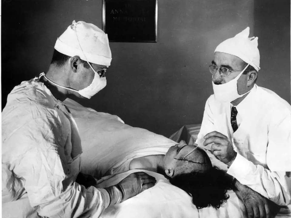Walter Freeman nad pacientkou, které provedl transorbitální lobotomii