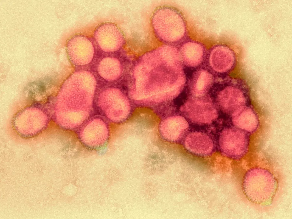 Chřipkový virus  H1N1, který v letech 1889-1895 připravil o život milion lidí