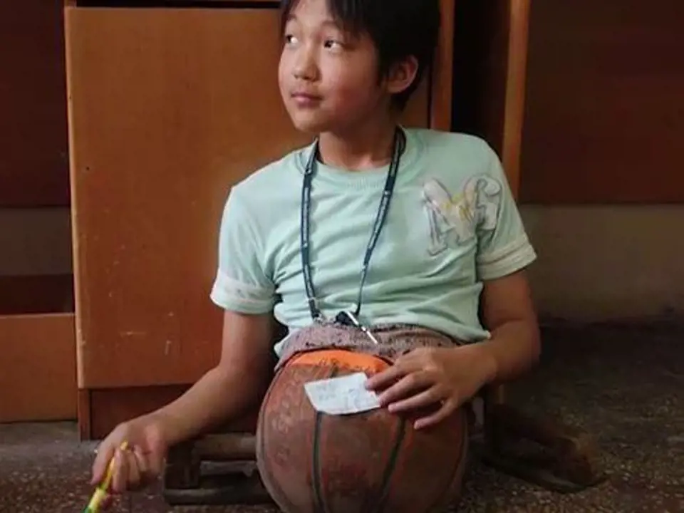 Qian Hongyan - Qian byly pouhé čtyři roky, když při autonehodě přišla o obě dolní končetiny. V deseti letech konečně dostala své první protézy. Dnes se mladá žena věnuje plavání a účastnila se i paralympiády.