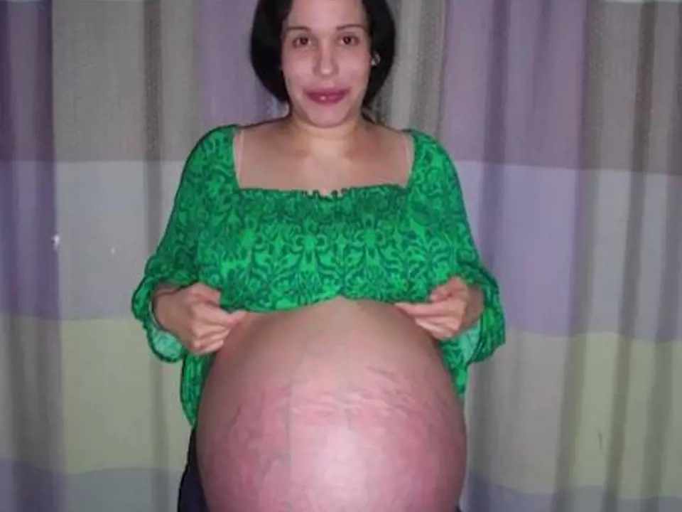 Nadya Suleman - tato žena je známá pod přezdívkou oktomáma (octomam), jelikož se jí podařilo po umělém oplodnění přivést na svět zdravá osmerčata.