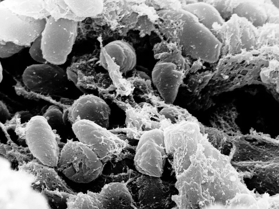 Původce moru bakterie Yersinia pestis pod elektronovým mikroskopem.