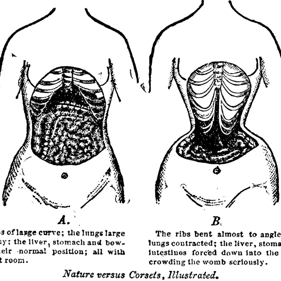 Anatomie ženského těla, jak ji lékaři popsali v roce 1903