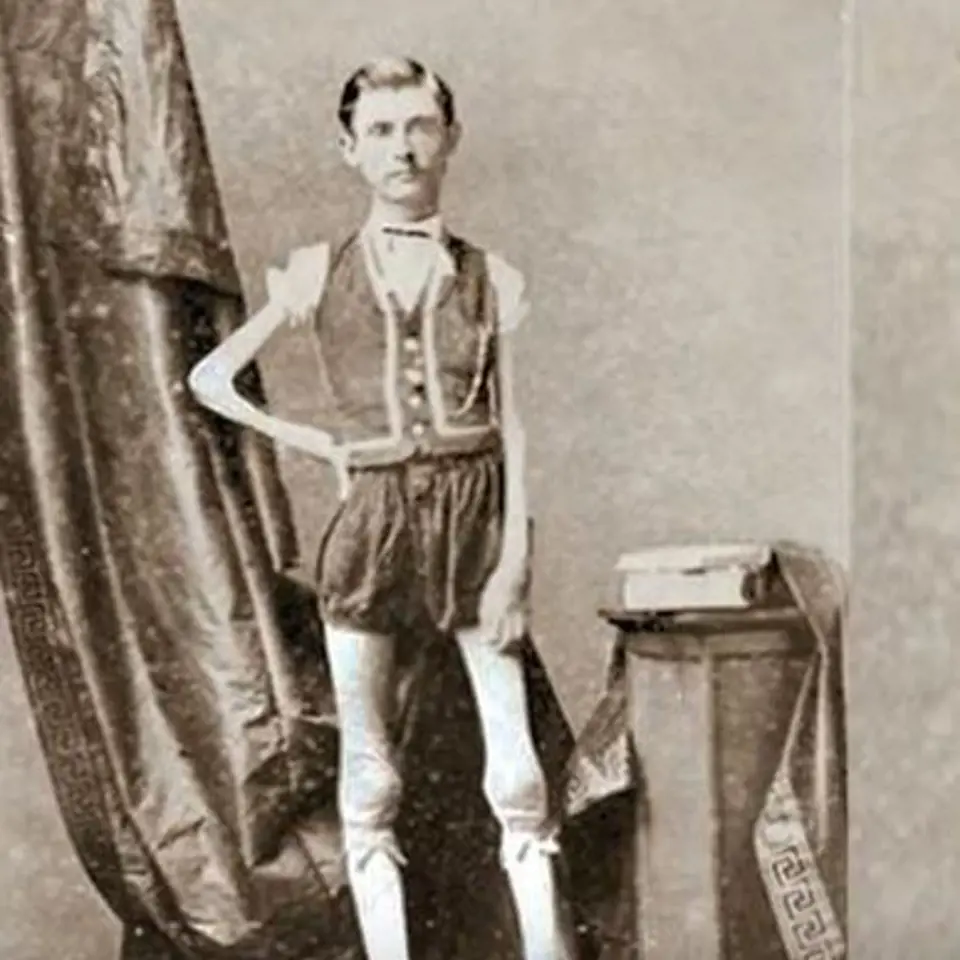 Isaac Sprague - Živoucí kostra, takovou dostal Isaac přezdívku. Isaac se narodil v roce 1841 a do svých 12 let byl normálním dítětem. Poté začal nekontrolovatelně hubnout.