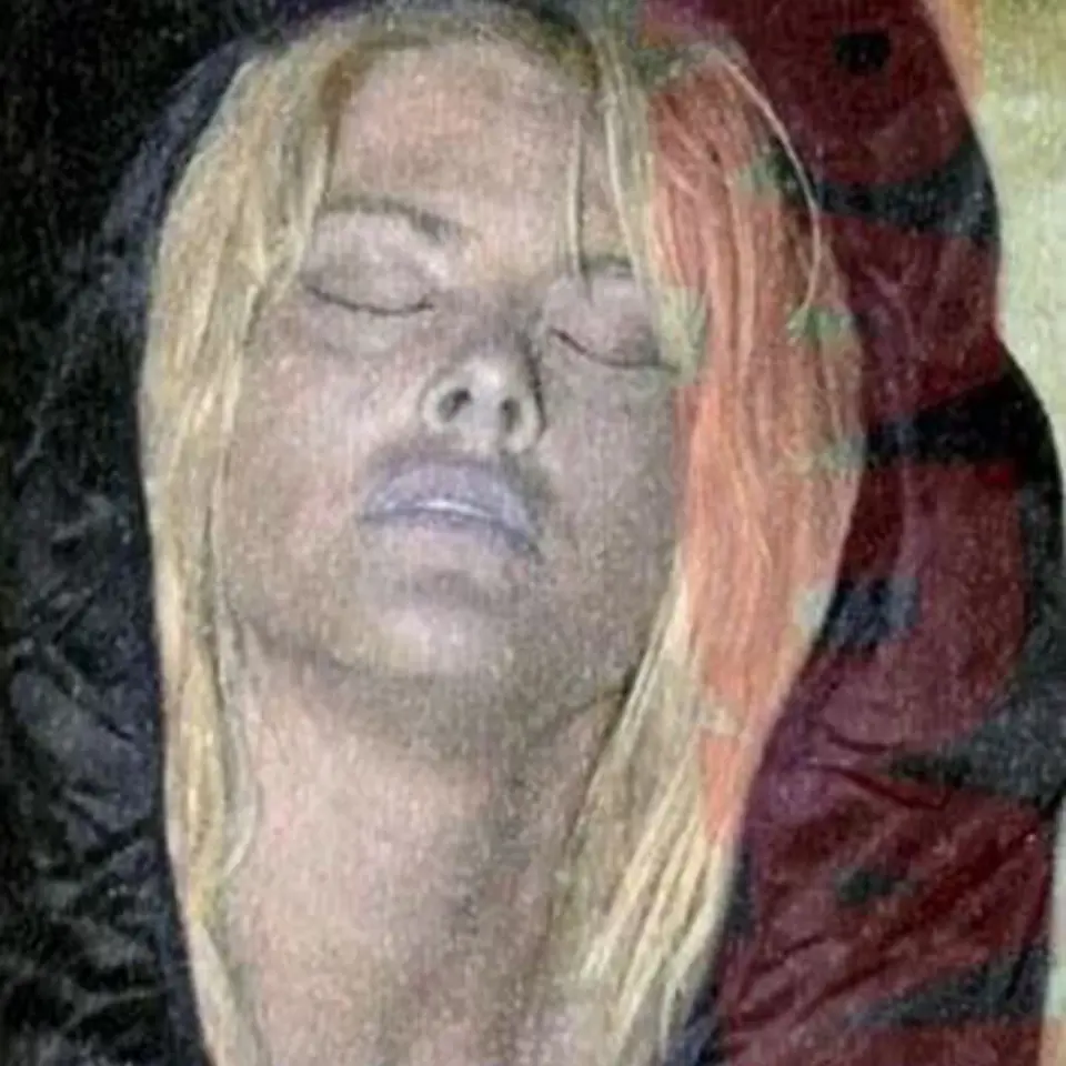Anna Nicole Smith po smrti v roce 2007, pravděpodobně se předávkovala léky a alkoholem.