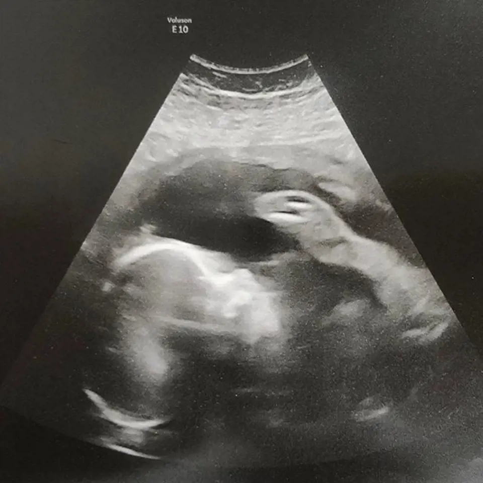 Sarah Allison je konečně těhotná.